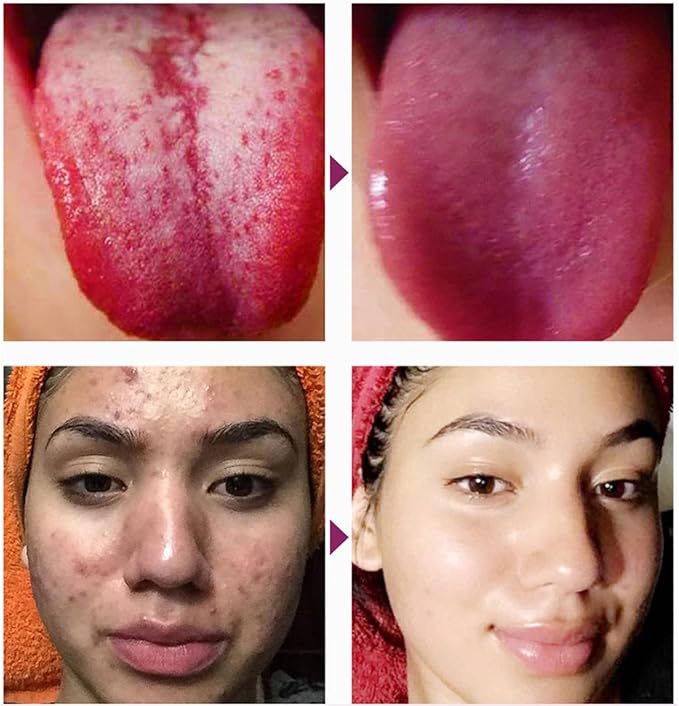 Foot Pads 100 Pieces-Premium Ginger Powder Bamboo Vinegar Feet Pads,Deep Cleansing Foot Patches for Feet Care