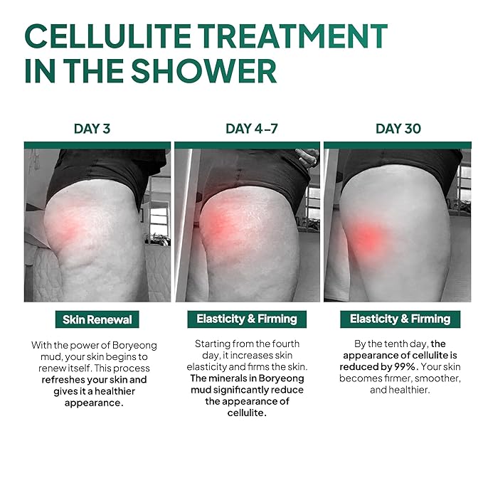 Anti Cellulite Mud Scrub Body Wash, Reduces Cellulite, Gentle Exfoliating, Improves Skin Texture, Provides a Smoother Look, 5.07 Fl Oz (6)