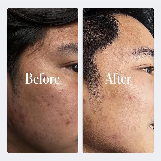 Geologie Retinol Anti-Aging Face Cream | Advanced .3% Retinol Formula for Effective Results | Reduce Fine Lines & Wrinkles | Protect & Repair Skin With Hyaluronic Acid & Niacinamide | For Men & Women